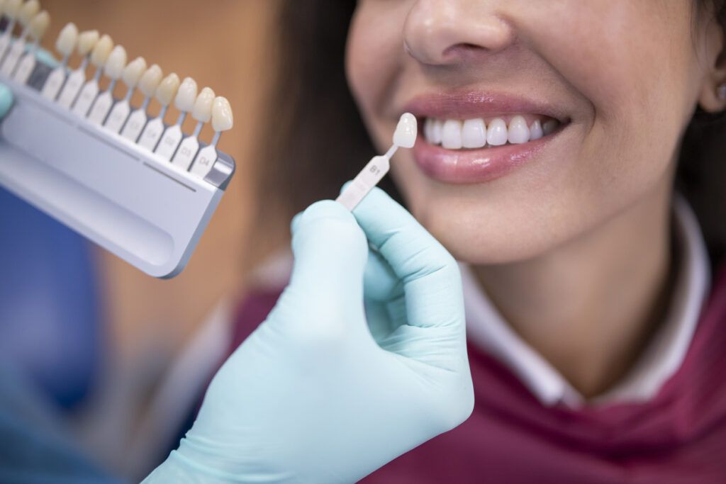 Qué es el blanqueamiento dental interno IMaxilodental Qué es el