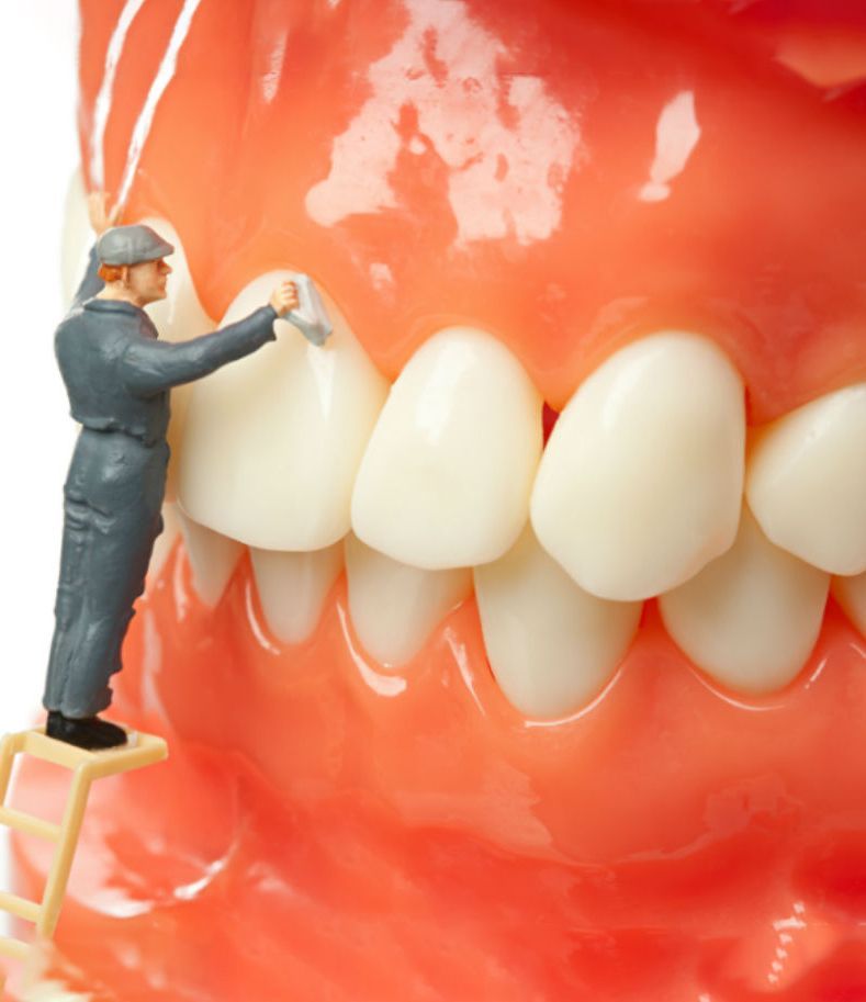 Se rompen fácilmente las carillas dentales? - IMaxilodental ¿Se rompen  fácilmente las carillas dentales?